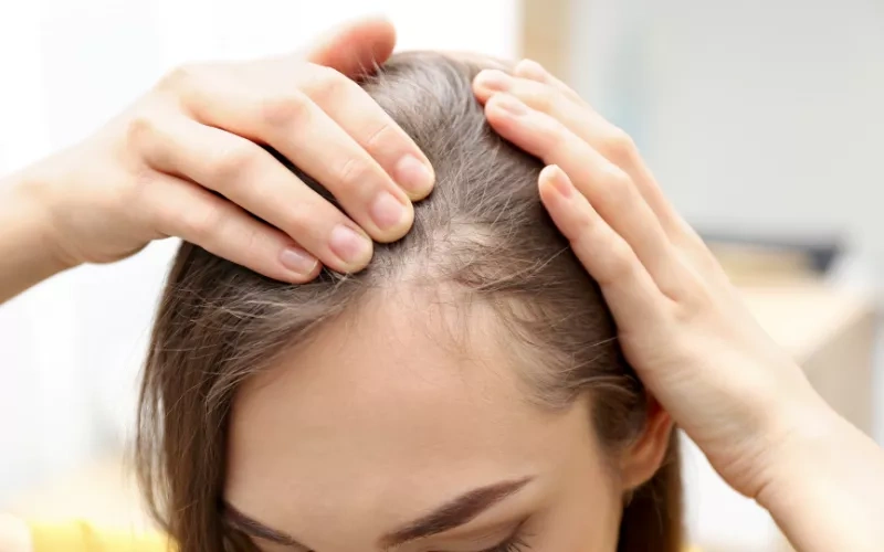 Mediceuticals Saturate Shampoo Шампунь проти випадіння та стоншення волосся для жінок (для сухої шкіри голови/волосся), 250мл 0000002438 фото