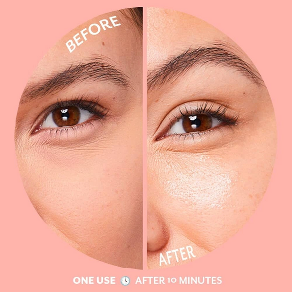 Patchology Освітлювальні патчі Serve Chilled&trade; Bubbly Eye Gels (15 пар) 0000001555 фото