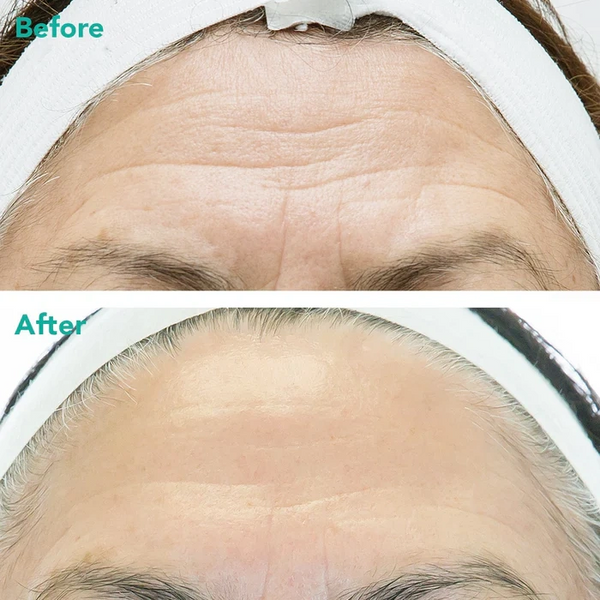 Rejuran Advanced Anti-Aging Retinol Serum Вдосконалена сироватка з ретинолом для глибокого омолодження, 30мл 0000003089 фото