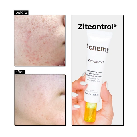 Acnemy Zitcontrol Крем для проблемної шкіри, 40мл 0000000758 фото